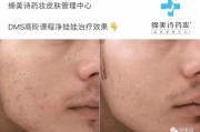 天美麻痘产精国入口,揭秘国货新势力崛起之谜